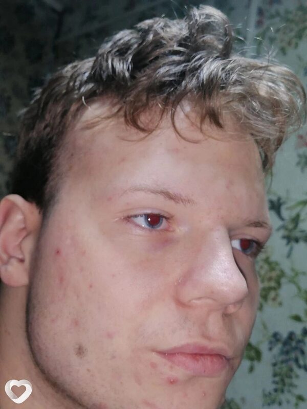 Никита, Чехов