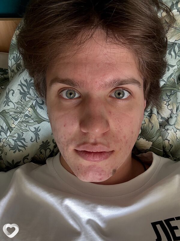 Алексей, 21, Москве — анкета №816260