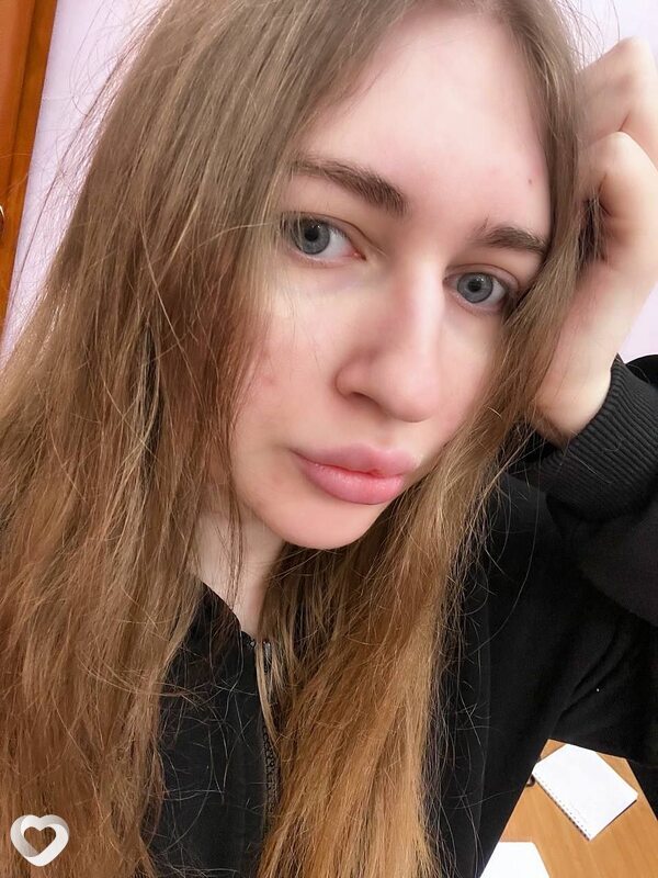 Аврора, Кыштым