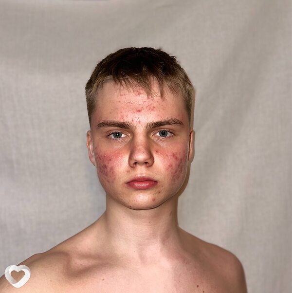 Денис, 20, Санкт-Петербурге — анкета №1086238