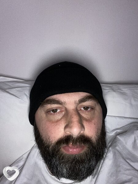 Shako Shako, Антополь