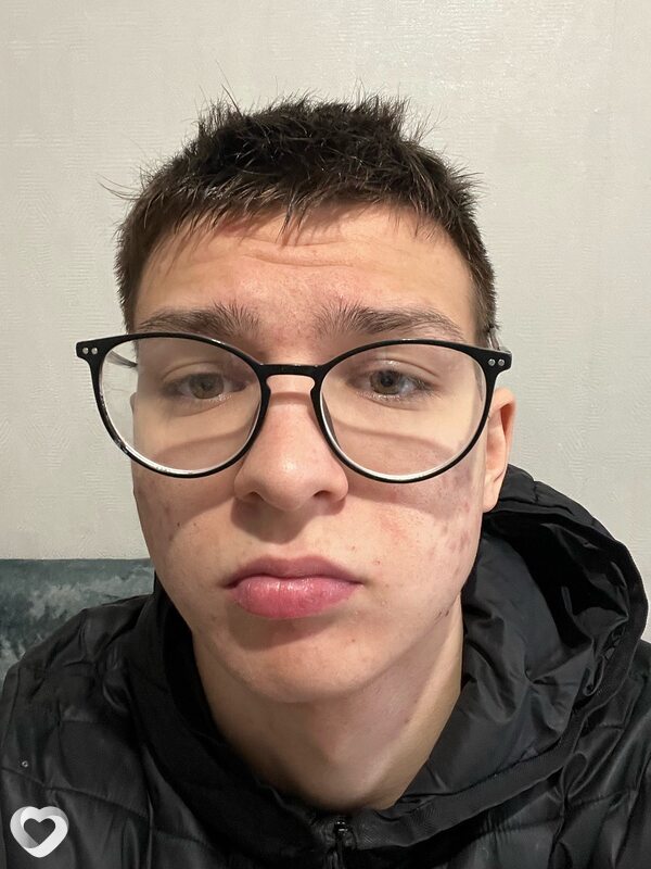 Игнат, 20, Москве — анкета №2052571