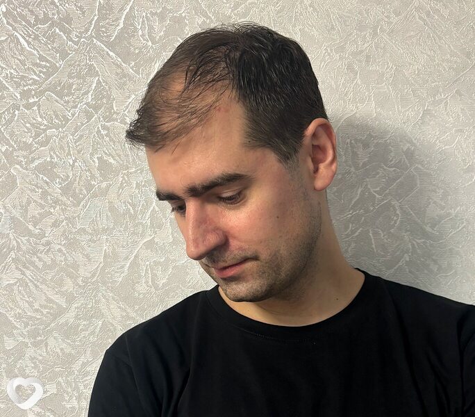 Александр, 35, Вологде — анкета №3412881