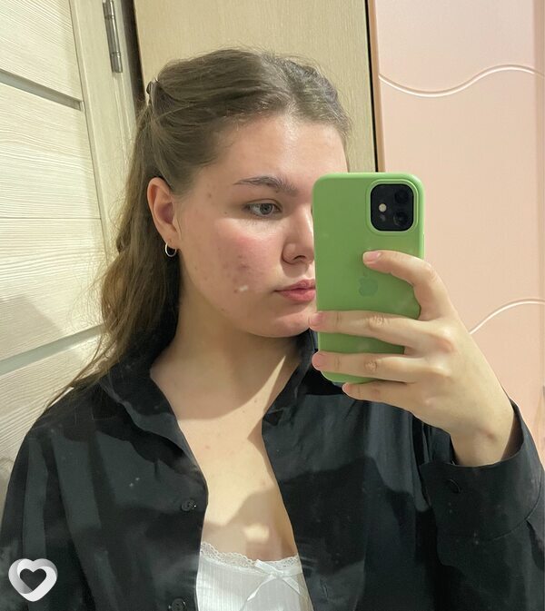 Alina, 18, Вологде — анкета №3425772