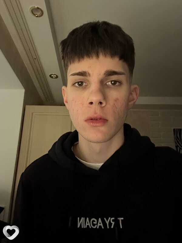 Антон, 19, Ставрополе — анкета №3510473