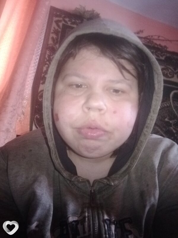 Аня, Вижница