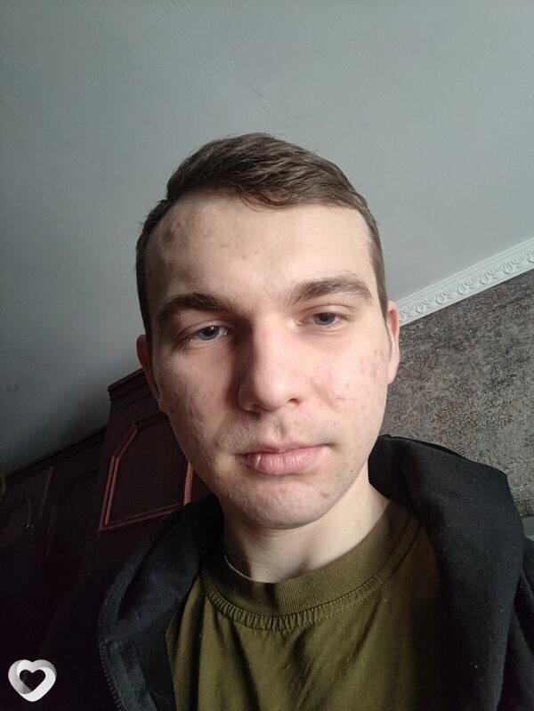 Толик, 22, Одессе — анкета №3822896