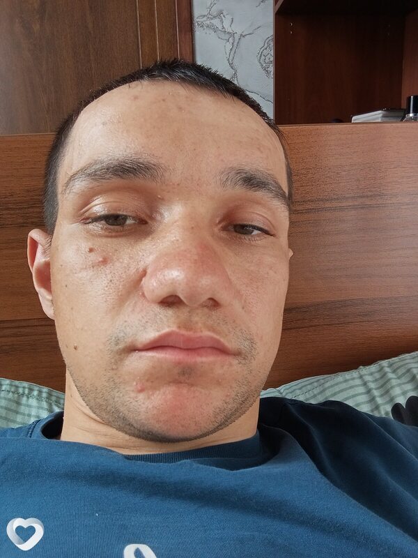 Павлик, Пестрецы