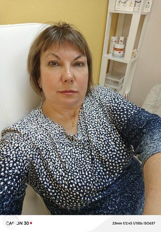 Алёна, Кандалакша